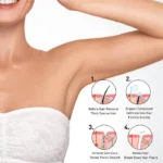 Kingyes Silky Beauty Painless Hair Removal silky beauty Spray for Men and Women Skin Care - Image 2